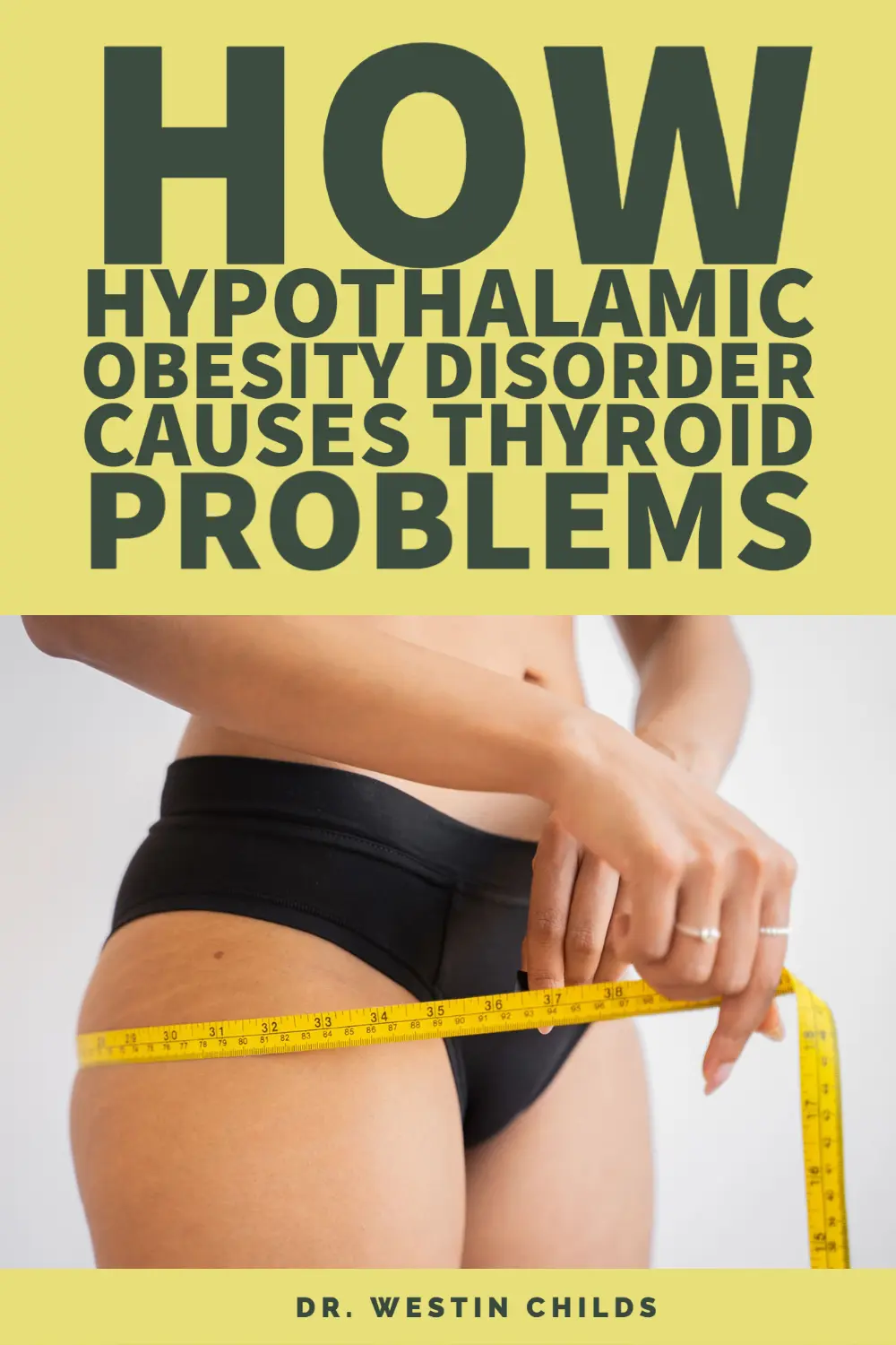 how hypothalamic obesity disorder causes thyroid problems pinterest image. 