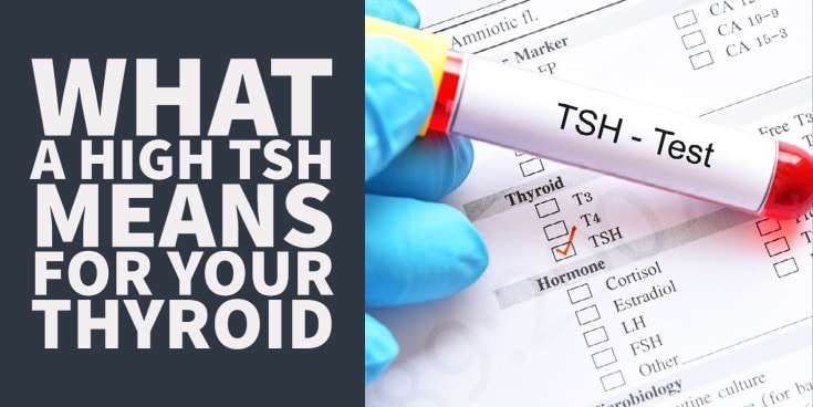 High TSH Symptoms Causes What It Means 44 OFF