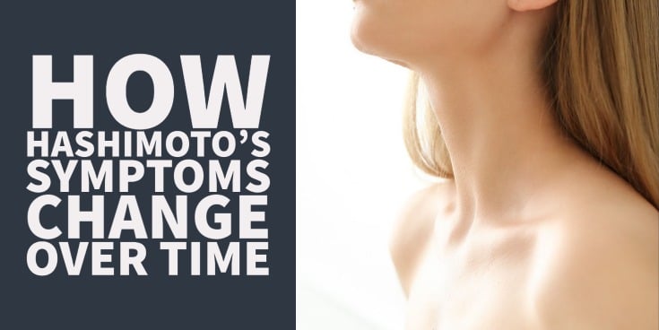 How hashimotos symptoms change over time