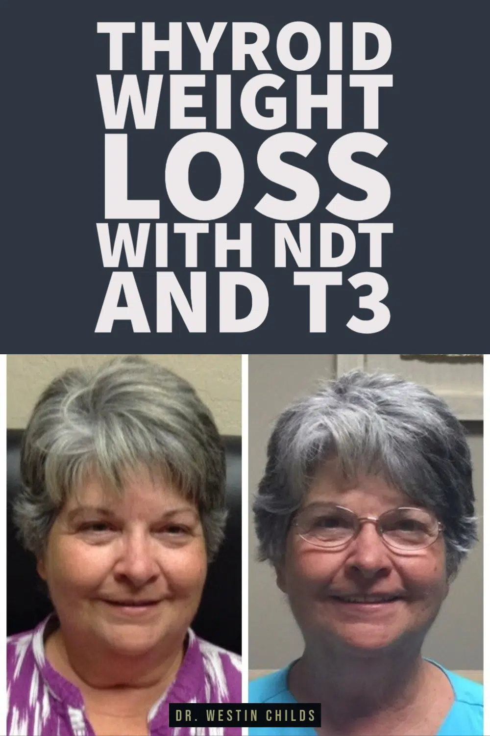 thyroid weight loss with NDT and T3 pinterest image. 