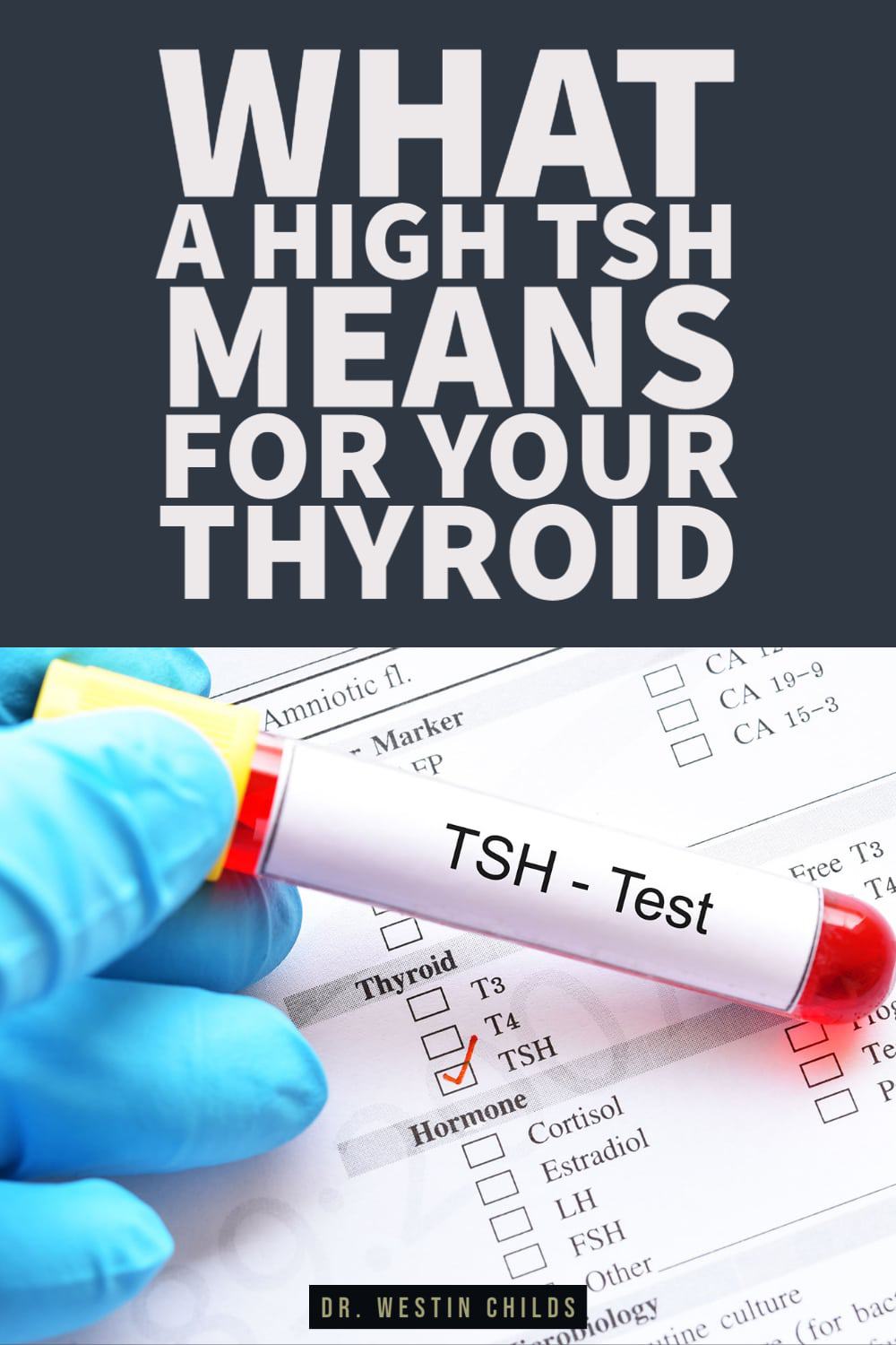 what a high TSH means for your thyroid