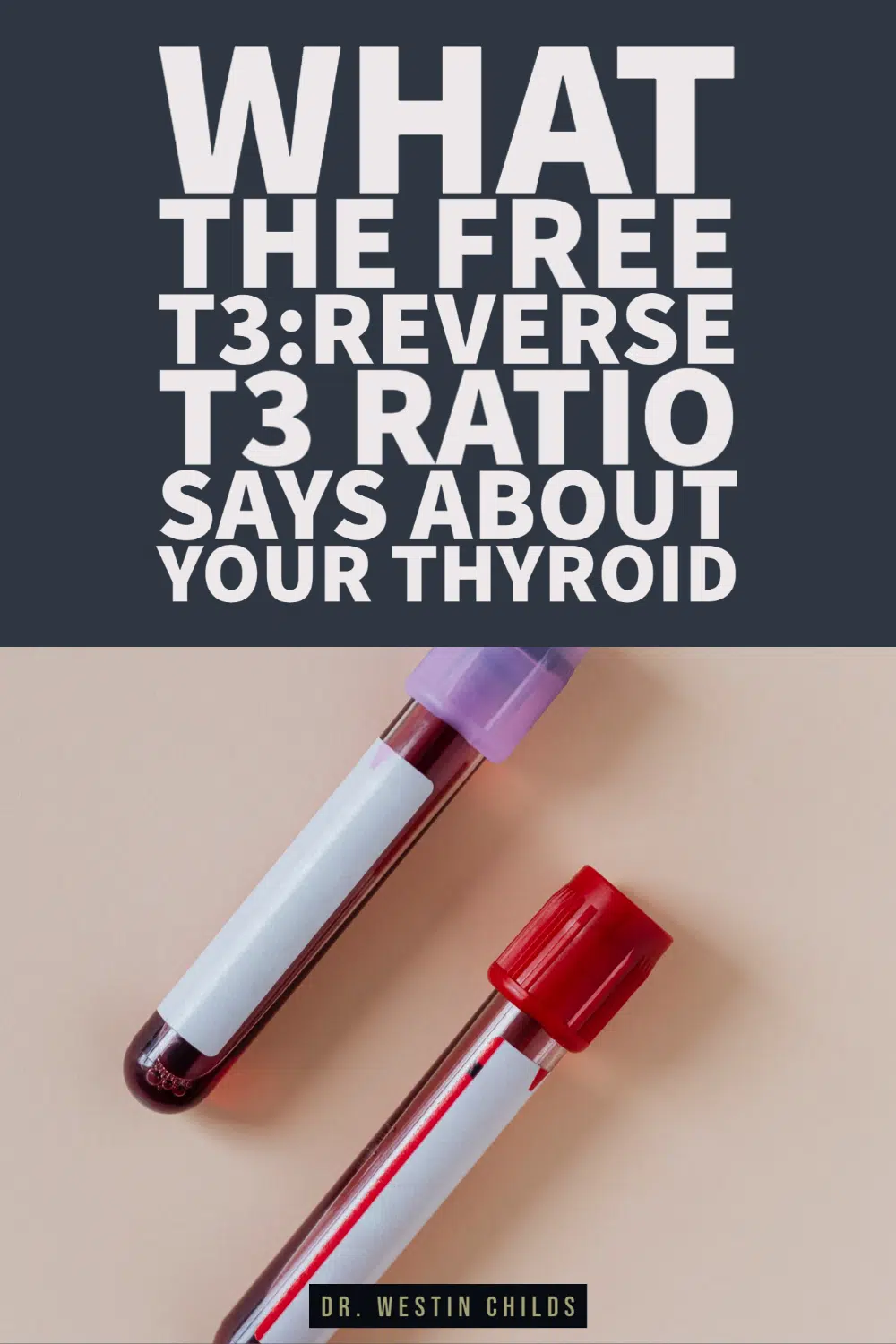 what the free t3 reverse t3 ratio says about your thyroid