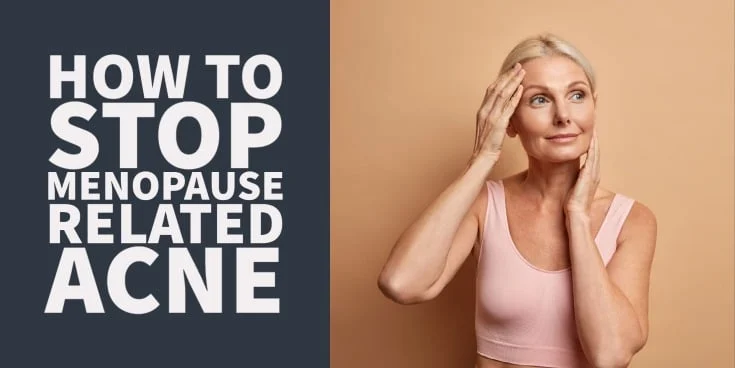 How to stop menopause related acne