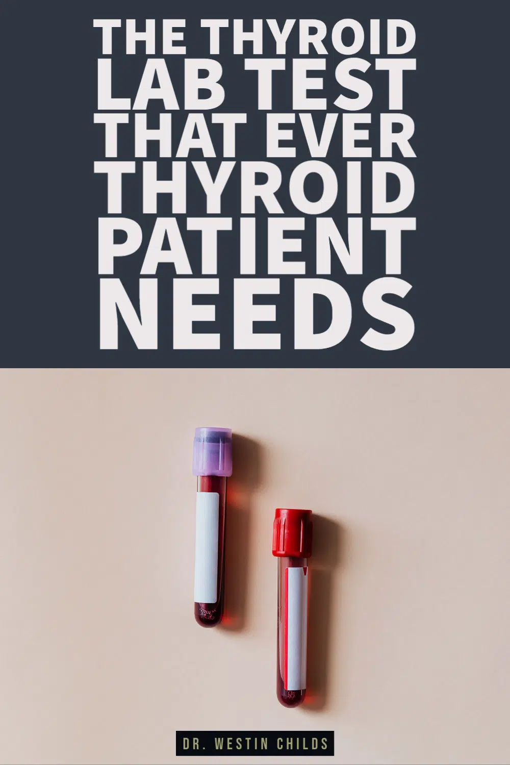 the thyroid lab test that ever thyroid patient needs the thyroid lab test that ever thyroid patient needs