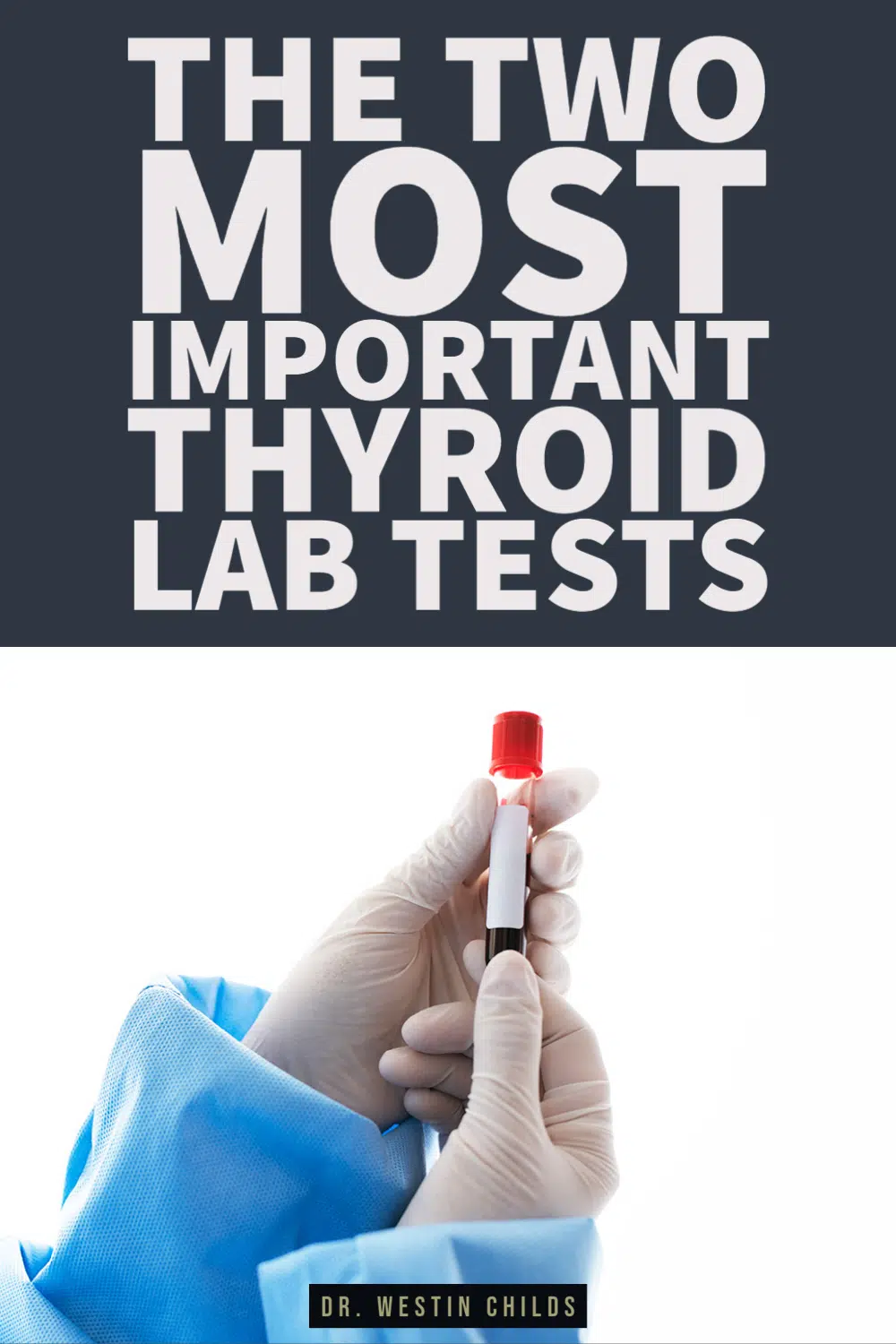 the two most important thyroid lab tests