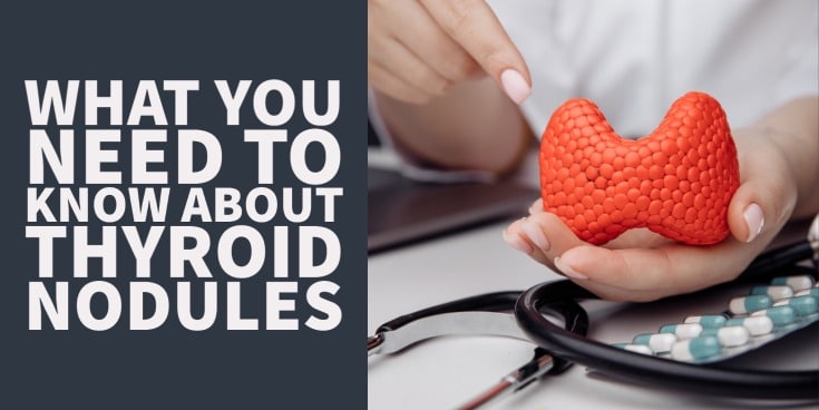 A beginner's guide to thyroid nodules: Causes, treatment and symptoms