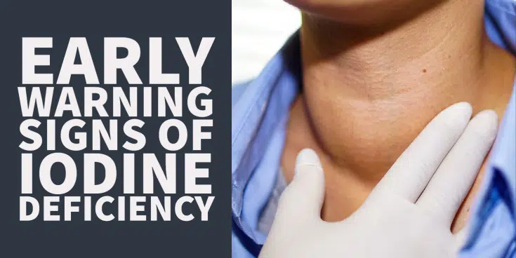 Early warnings signs of iodine deficiency