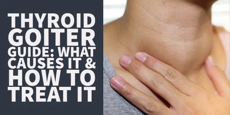 thyroid goiter treatment guide