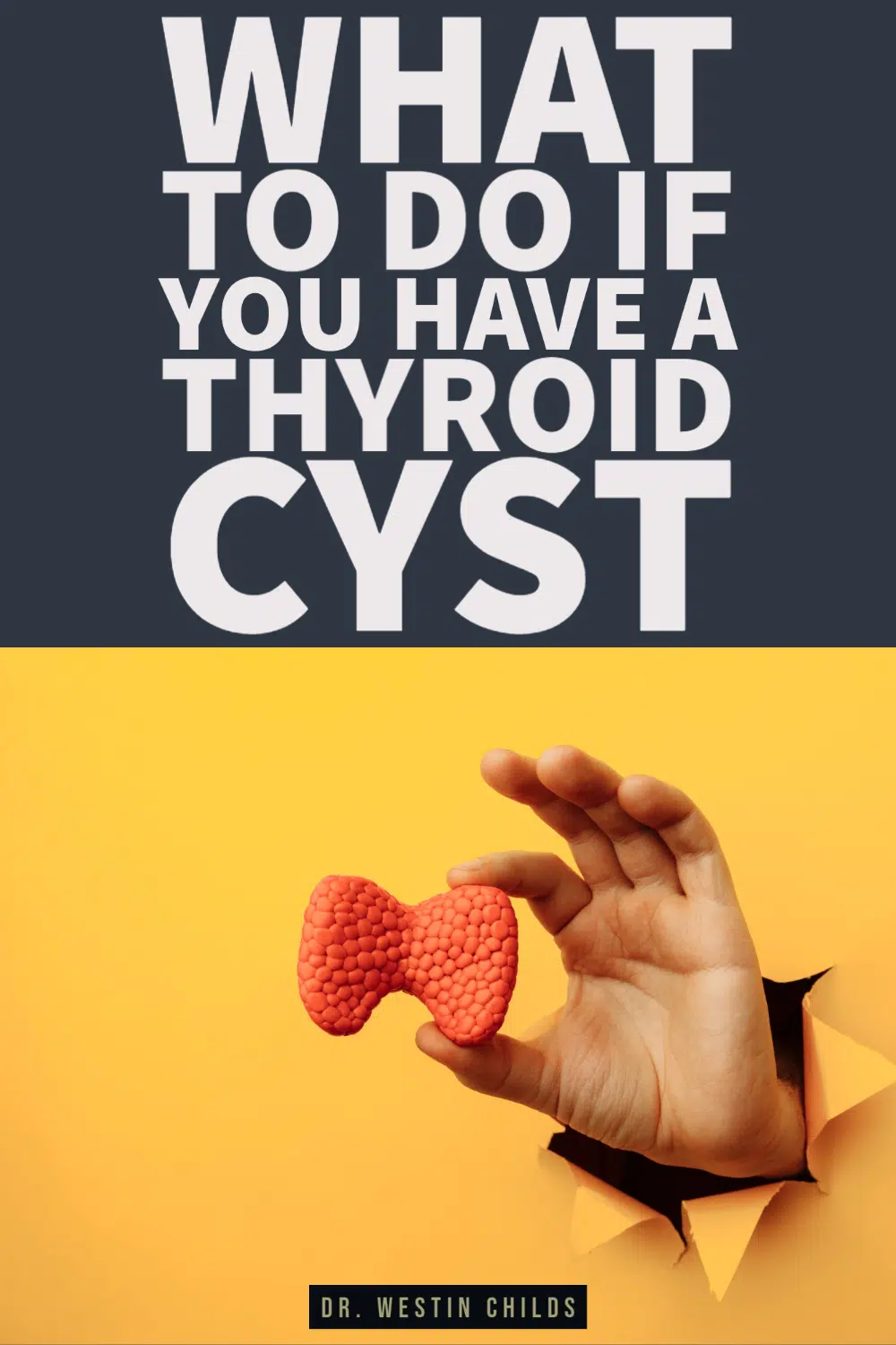 what to do if you have a thyroid cyst