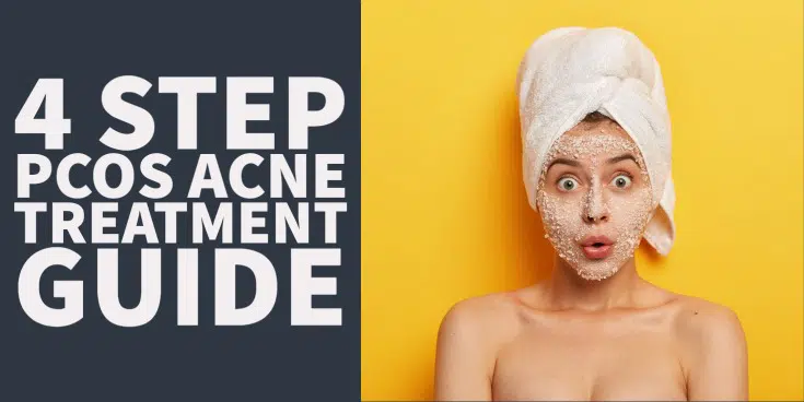 4 step PCOS acne treatment guide: Fix your skin from the inside and out