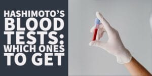 hashimoto's blood tests