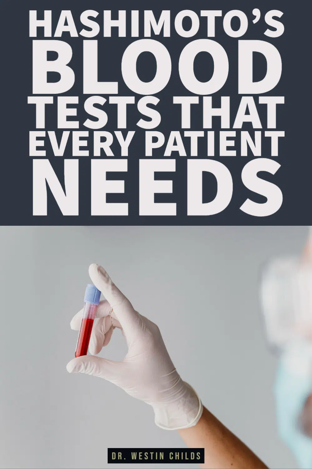 hashimoto's blood tests that ever patient needs