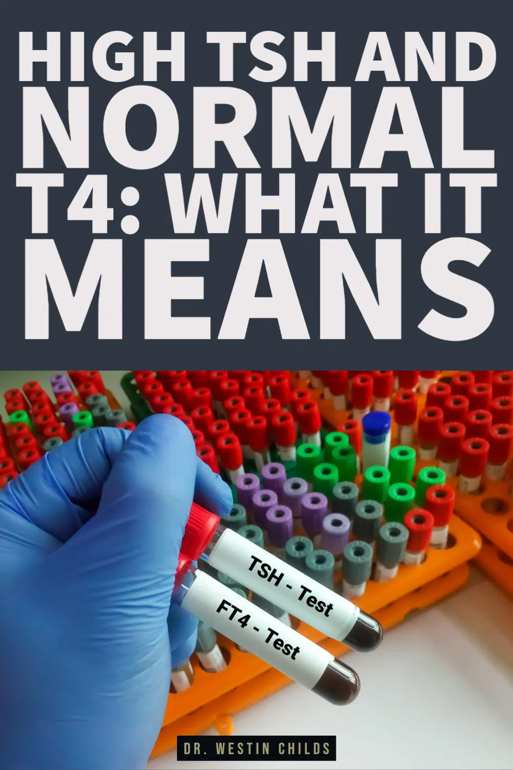 high TSH and normal T4: what it means high TSH and normal T4: what it means