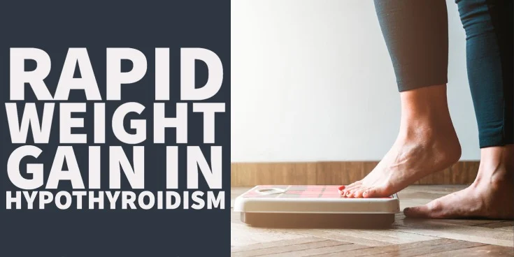 Rapid Weight Gain in Hypothyroidism