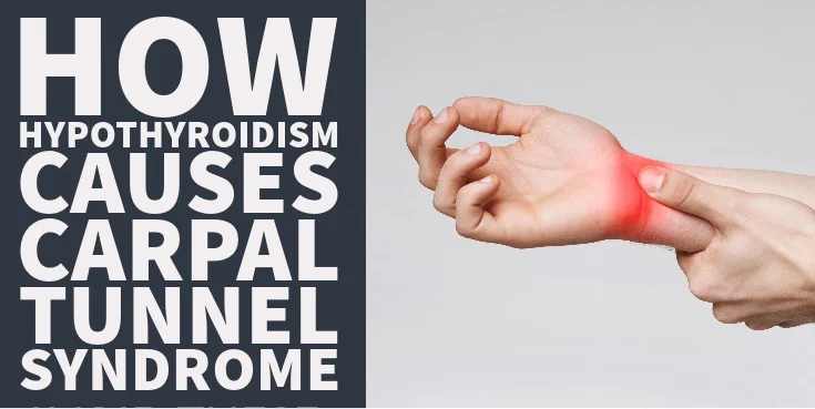 how hypothyroidism causes carpal tunnel syndrome