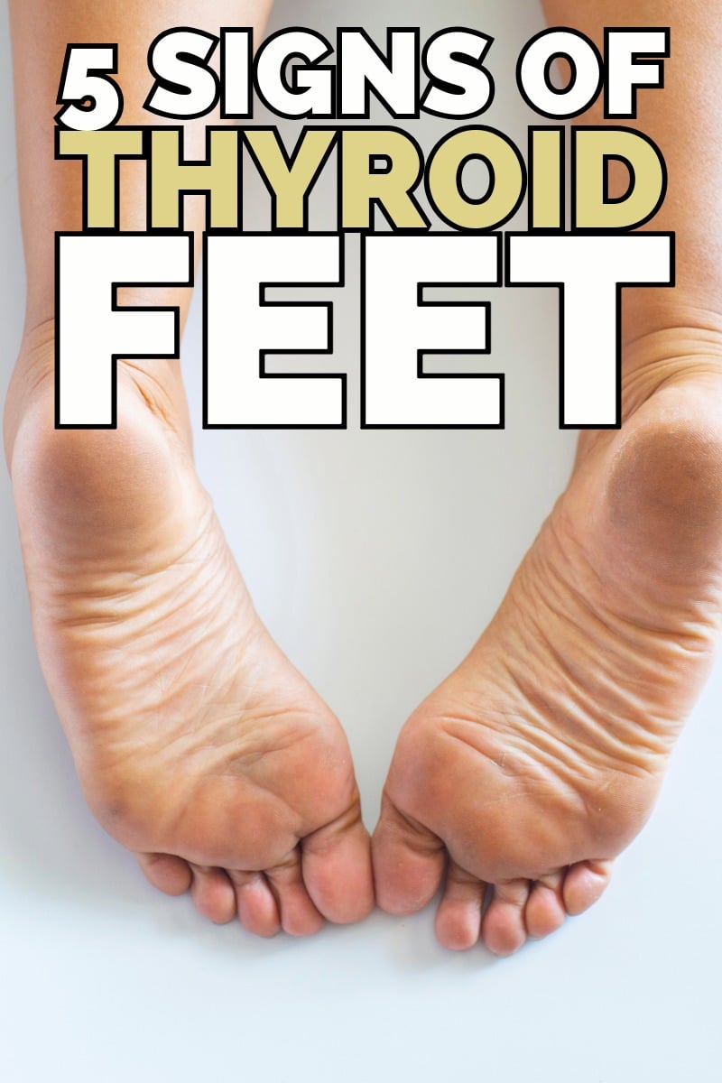 5 signs of thyroid feet 5 signs of thyroid feet