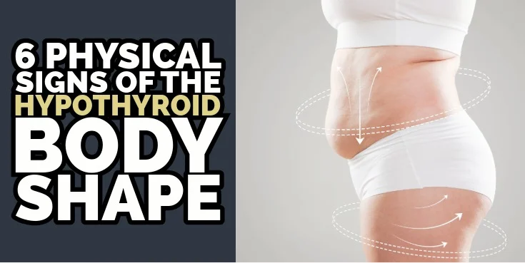 6 physical signs of the Hypothyroid body shape